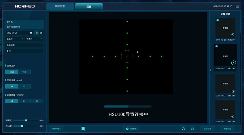 恒宇醫(yī)療OCT系統(tǒng)醫(yī)療影像軟件界面設(shè)計-藍(lán)藍(lán)設(shè)計
